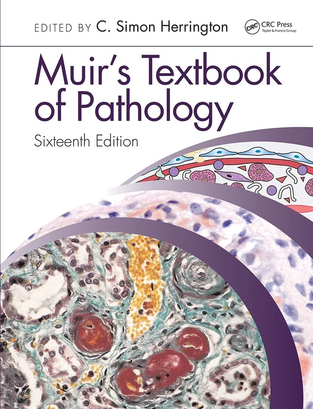 Muir's Textbook of Pathology: Sixteenth Edition International Student Edition