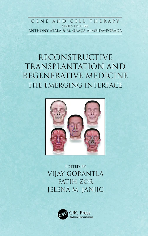 Reconstructive Transplantation and Regenerative Medicine: The Emerging Interface (Gene and Cell Therapy)
