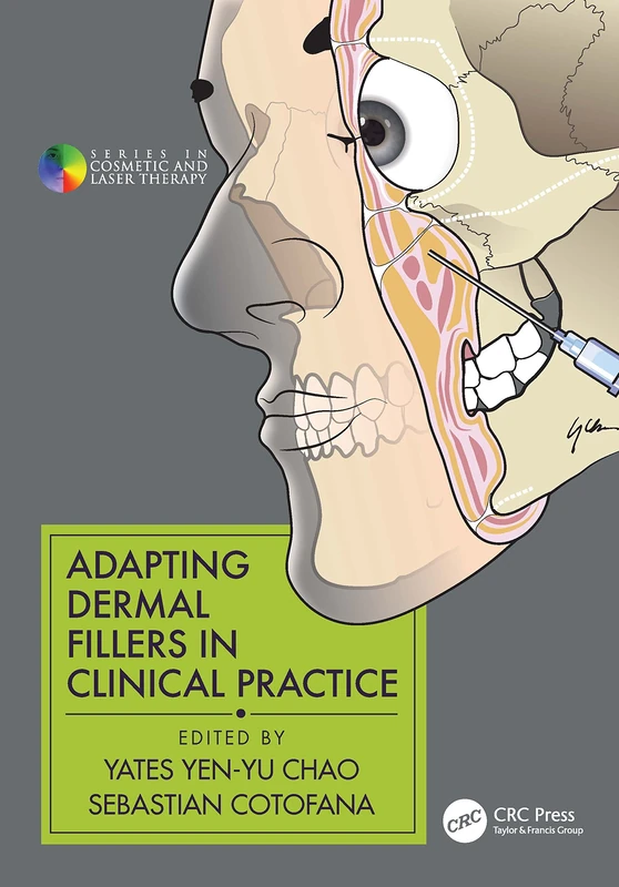 Adapting Dermal Fillers in Clinical Practice (Series in Cosmetic and Laser Therapy)