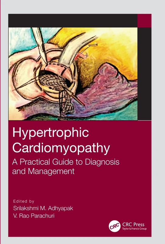 Hypertrophic Cardiomyopathy: A Practical Guide to Diagnosis and Management