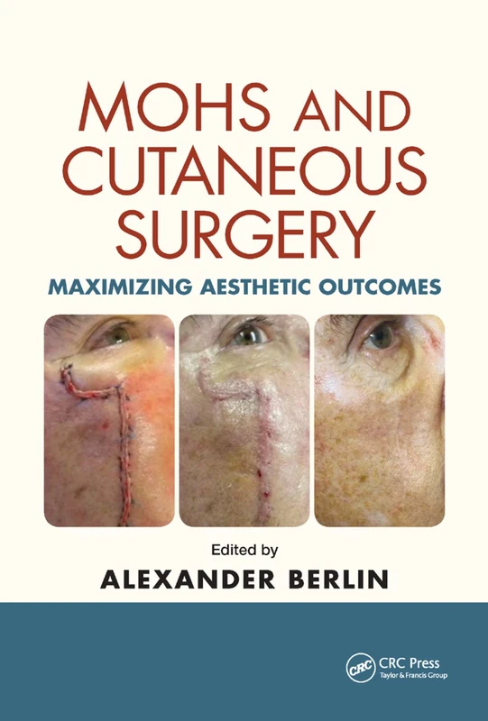Mohs and Cutaneous Surgery: Maximizing Aesthetic Outcomes
