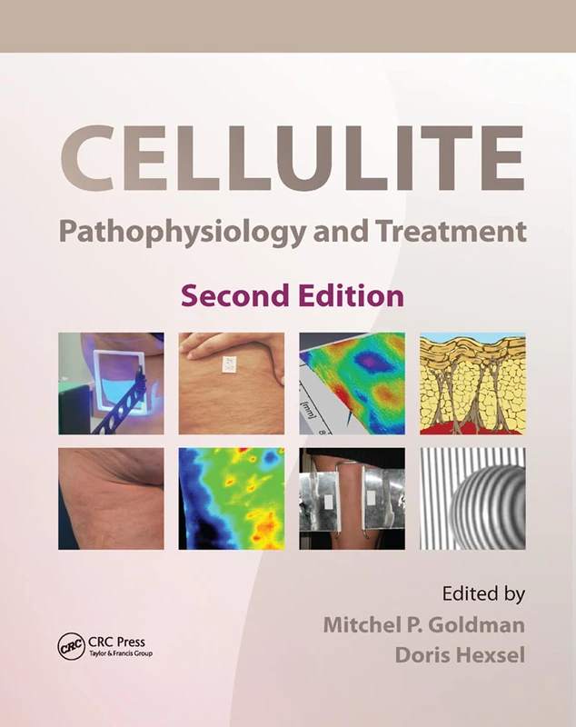 Cellulite: Pathophysiology and Treatment (Basic and Clinical Dermatology, 45)