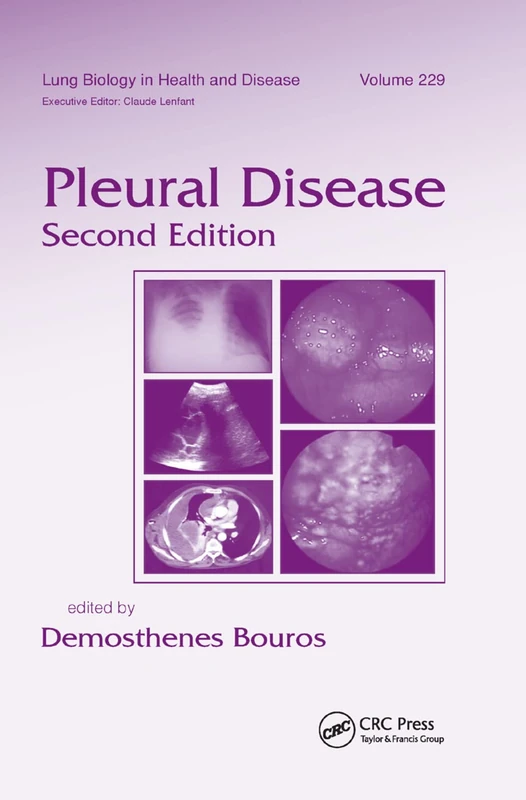 Pleural Disease (Lung Biology in Health and Disease, 229)