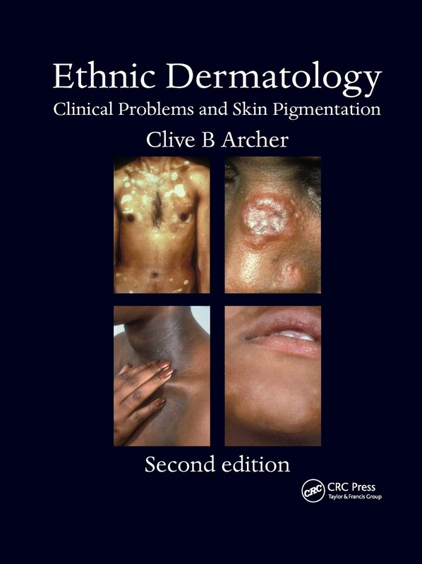 Ethnic Dermatology: Clinical Problems and Skin Pigmentation
