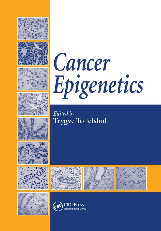 Cancer Epigenetics