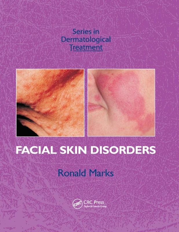 Facial Skin Disorders (Series in Dermatological Treatment)