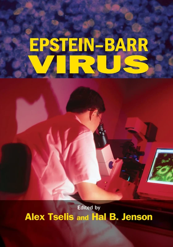 Epstein-Barr Virus: 38 (Infectious Disease and Therapy)