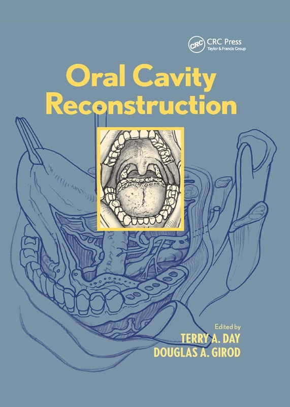 Oral Cavity Reconstruction - Image 1