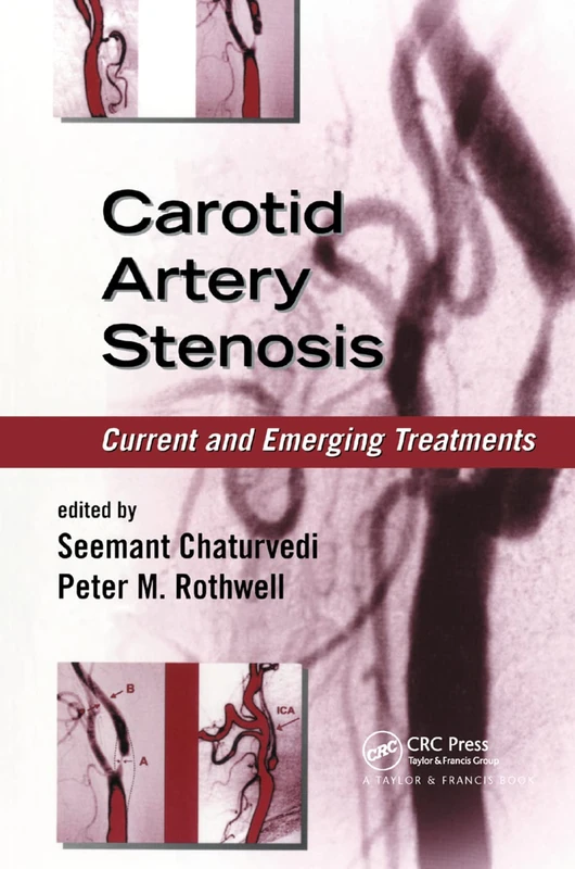 Carotid Artery Stenosis: Current and Emerging Treatments (Neurological Disease and Therapy, 72)