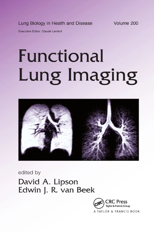 Functional Lung Imaging (Lung Biology in Health)