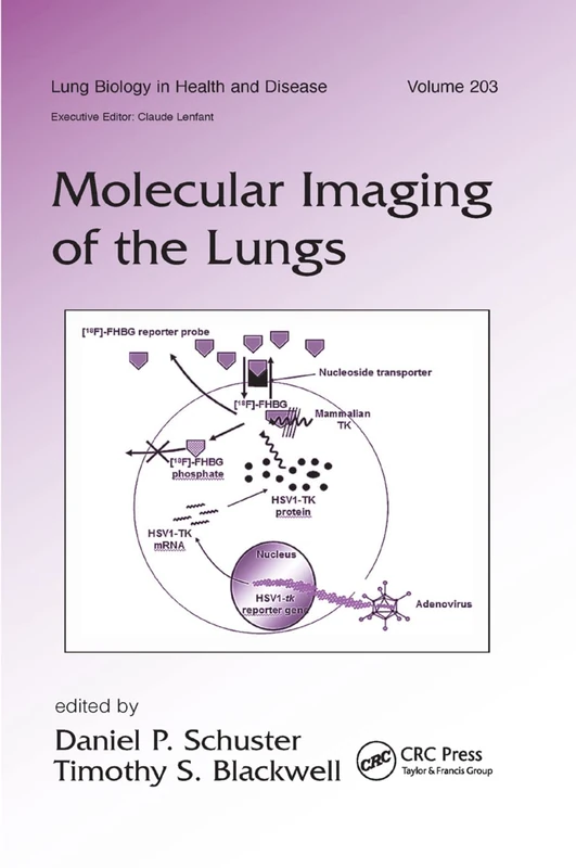 Molecular Imaging of the Lungs: 203 (Lung Biology in Health and Disease) - Image 1