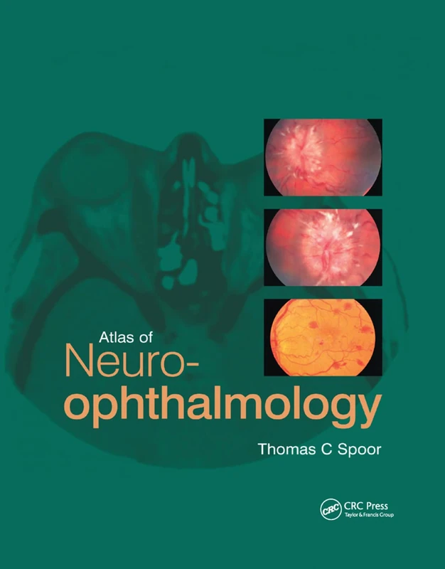 Atlas of Neuro-ophthalmology - Image 1