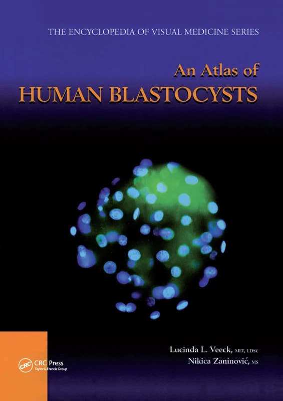 An Atlas of Human Blastocysts (Encyclopedia of Visual Medicine Series)