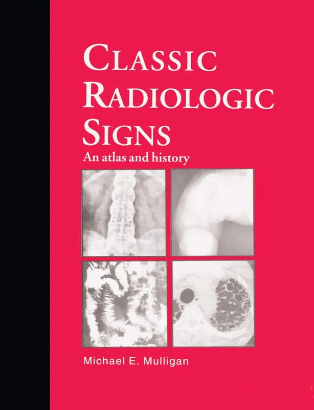 Classic Radiologic Signs: An Atlas and History