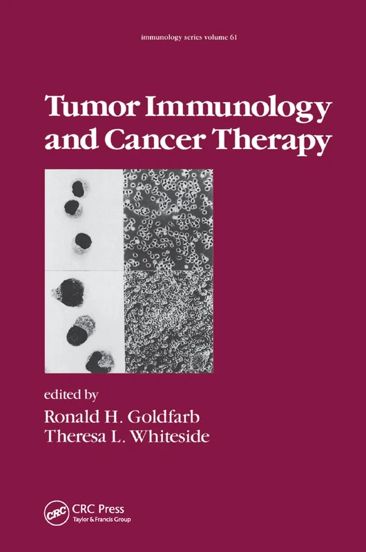Tumor Immunology and Cancer Therapy: 61