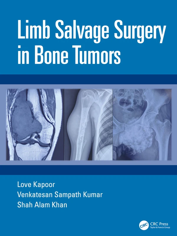 CRC Press - Limb Salvage Surgery in Bone Tumors Book