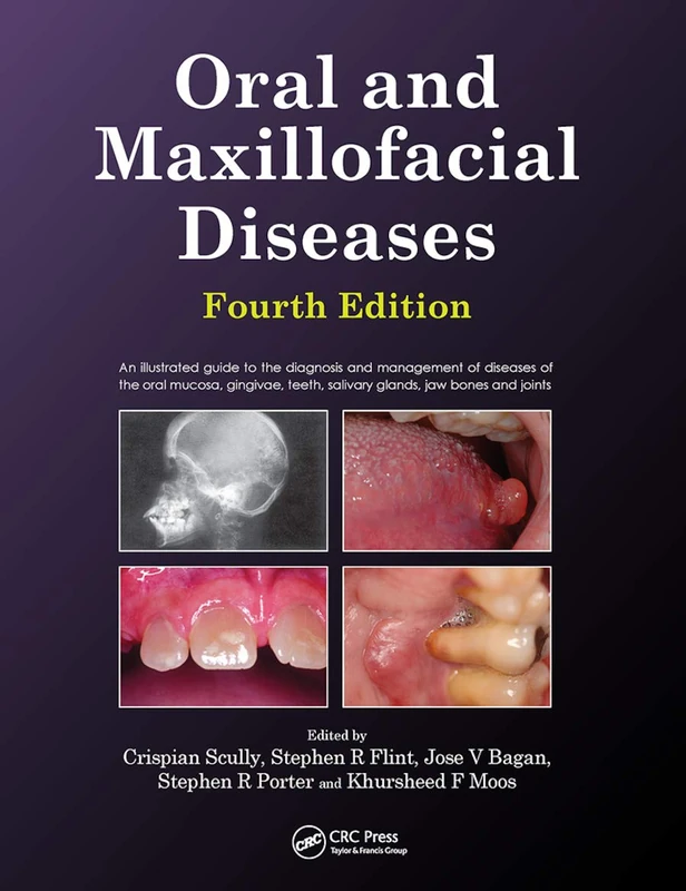 Oral and Maxillofacial Diseases, Fourth Edition: An Illustrated Guide to the Diagnosis and Management of Diseases of the Oral Mucosa, Gingivae, Teeth, Salivary Glands, Jaw Bones and Joints
