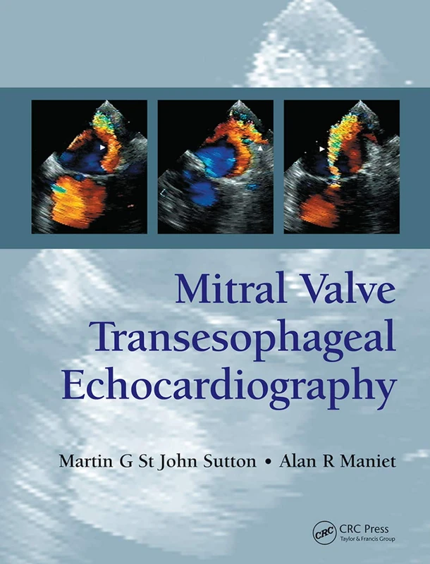 Mitral Valve Transesophageal Echocardiography - Image 1