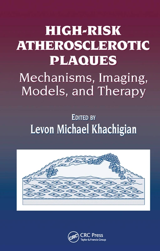 High-Risk Atherosclerotic Plaques: Mechanisms, Imaging, Models, and Therapy