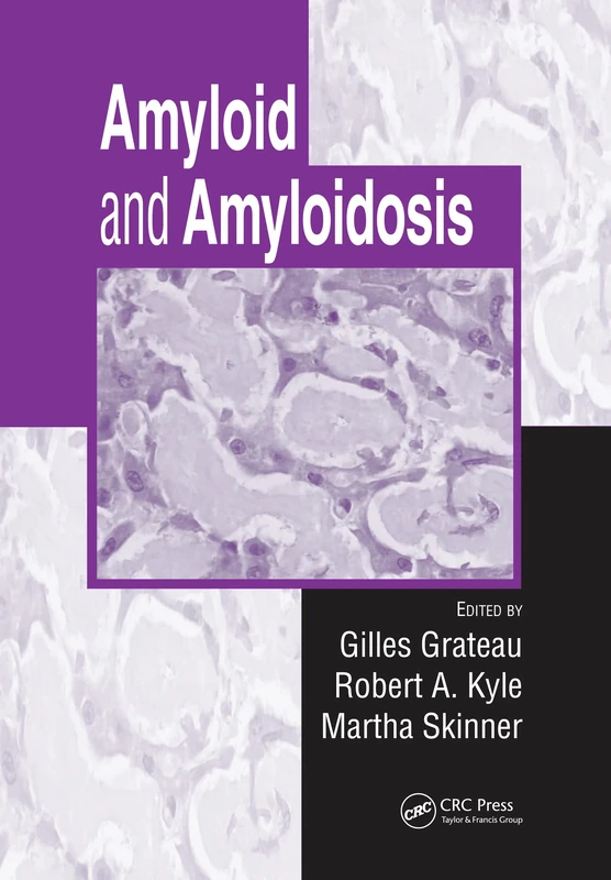 CRC Press - Amyloid and Amyloidosis Medical Reference Book