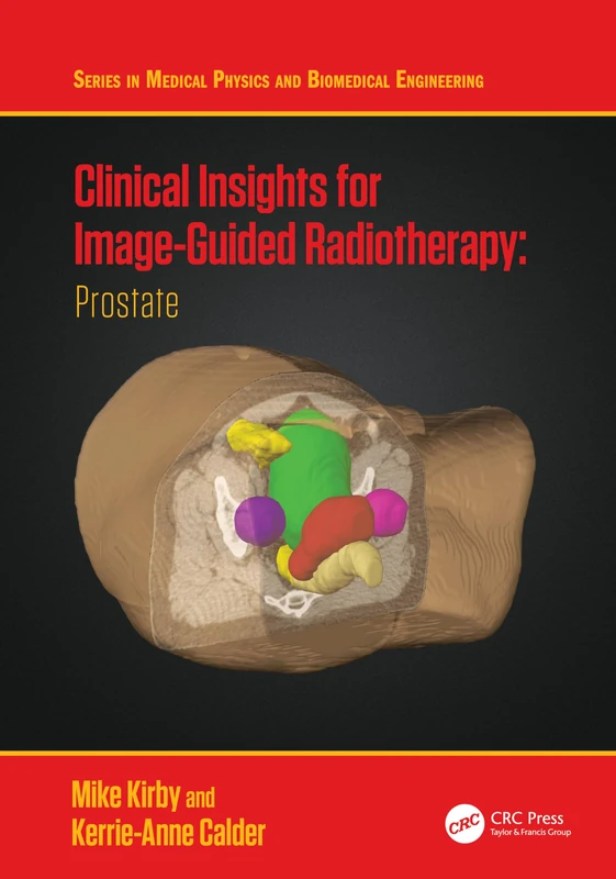 Clinical Insights for Image-Guided Radiotherapy: Prostate (Series in Medical Physics and Biomedical Engineering)