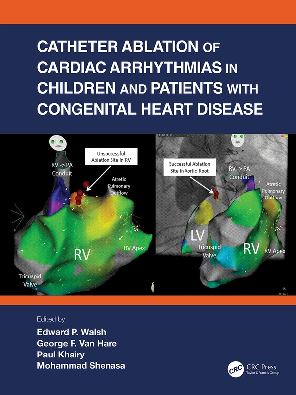 Catheter Ablation of Cardiac Arrhythmias in Children and Patients with Congenital Heart Disease - Image 1