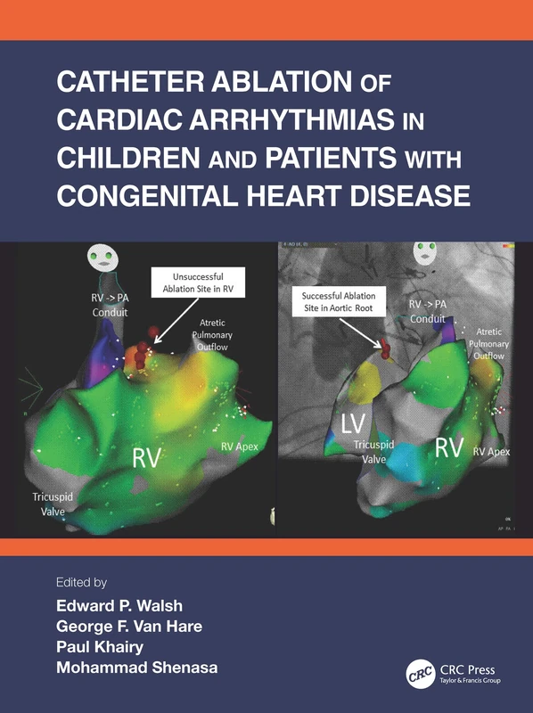 Catheter Ablation of Cardiac Arrhythmias in Children and Patients with Congenital Heart Disease - Image 1