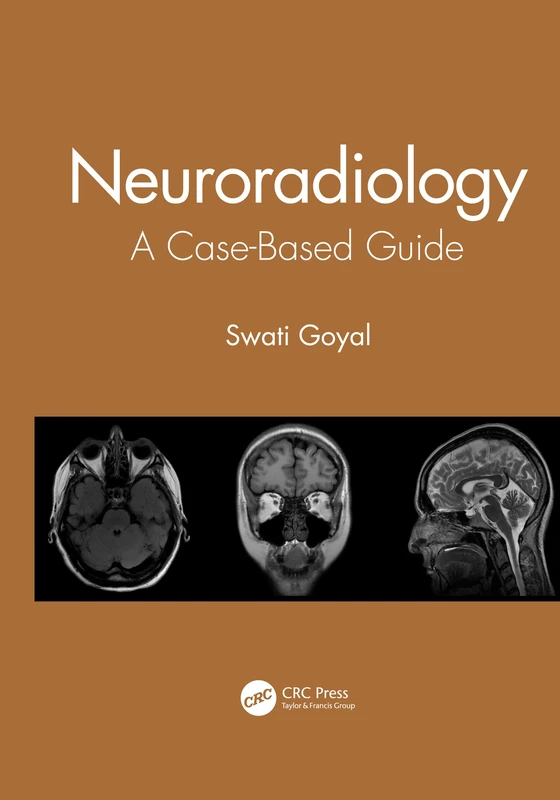 Neuroradiology: A Case-Based Guide