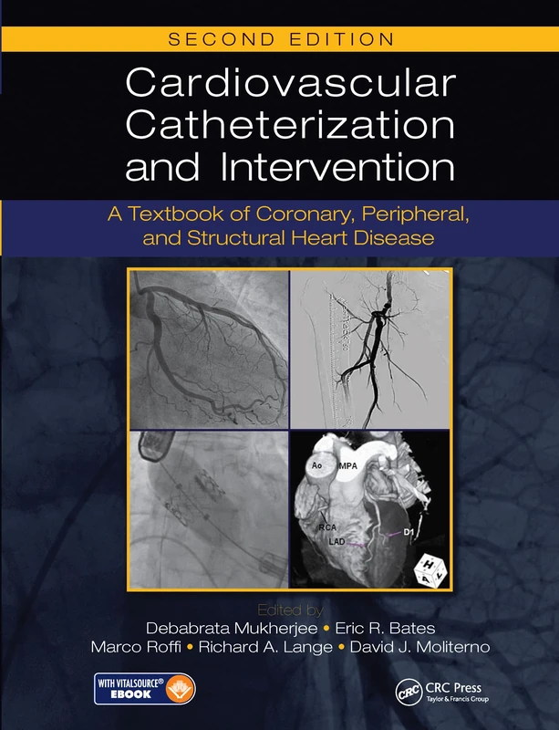 Cardiovascular Catheterization and Intervention: A Textbook of Coronary, Peripheral, and Structural Heart Disease, Second Edition