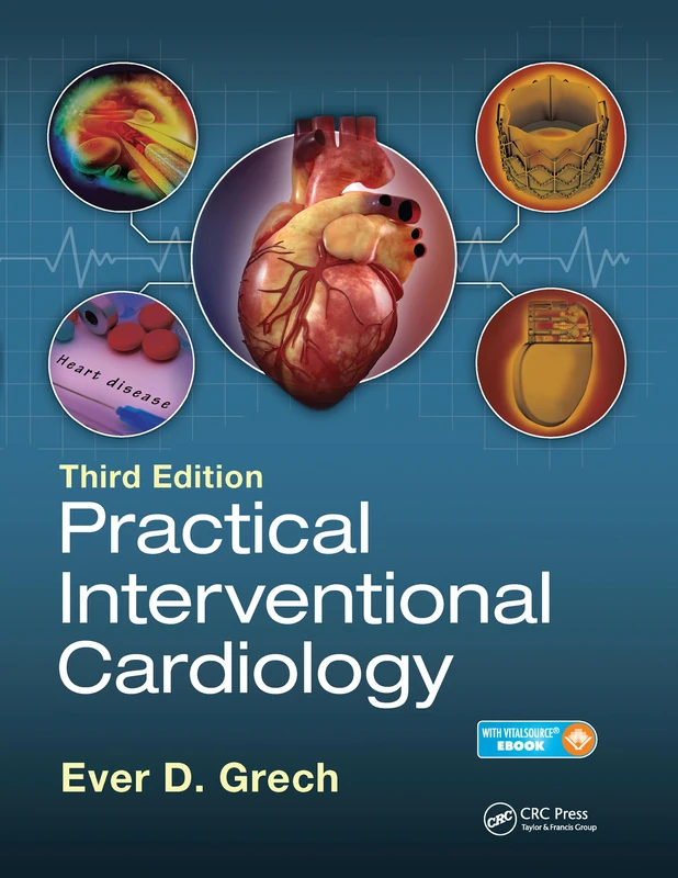 Practical Interventional Cardiology: Third Edition