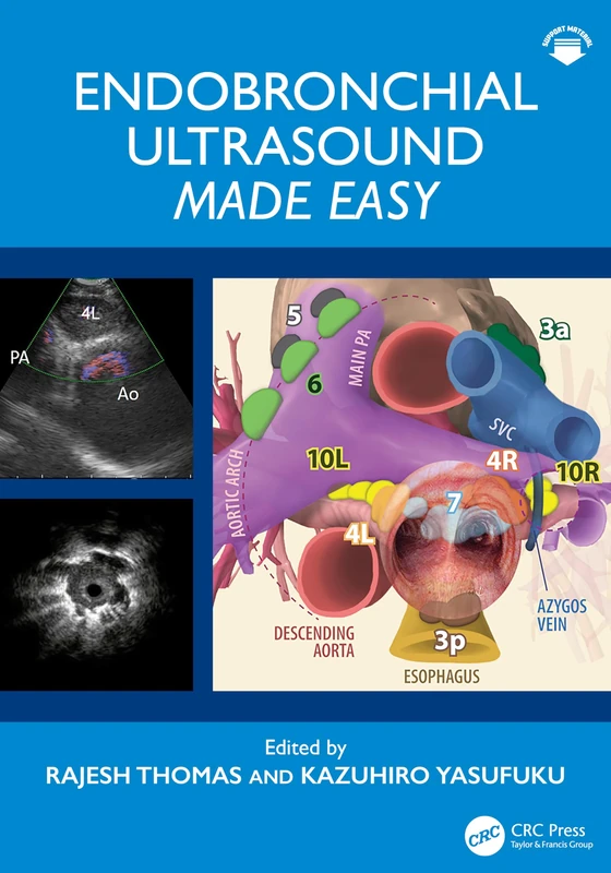 Endobronchial Ultrasound Made Easy: Made Easy