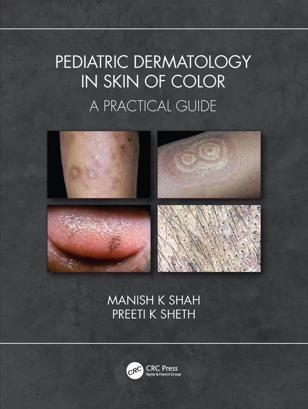 Pediatric Dermatology in Skin of Color: A Practical Guide