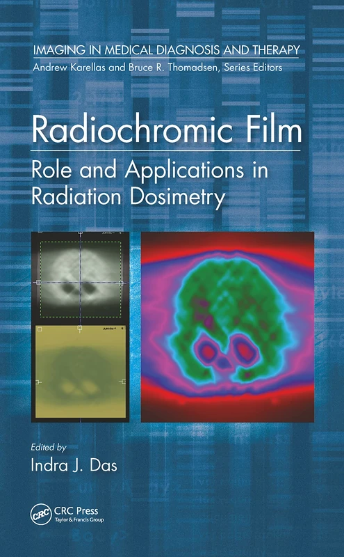 Radiochromic Film: Role and Applications in Radiation Dosimetry (Imaging in Medical Diagnosis and Therapy)