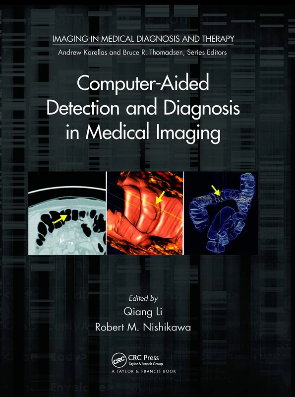 Computer-Aided Detection and Diagnosis in Medical Imaging (Imaging in Medical Diagnosis and Therapy)