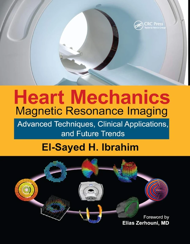 Heart Mechanics: Magnetic Resonance Imaging―Advanced Techniques, Clinical Applications, and Future Trends