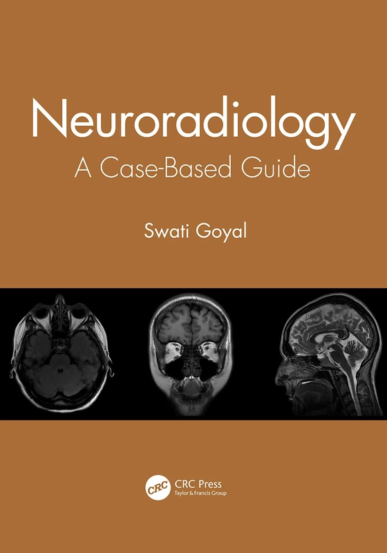 Neuroradiology: A Case-Based Guide