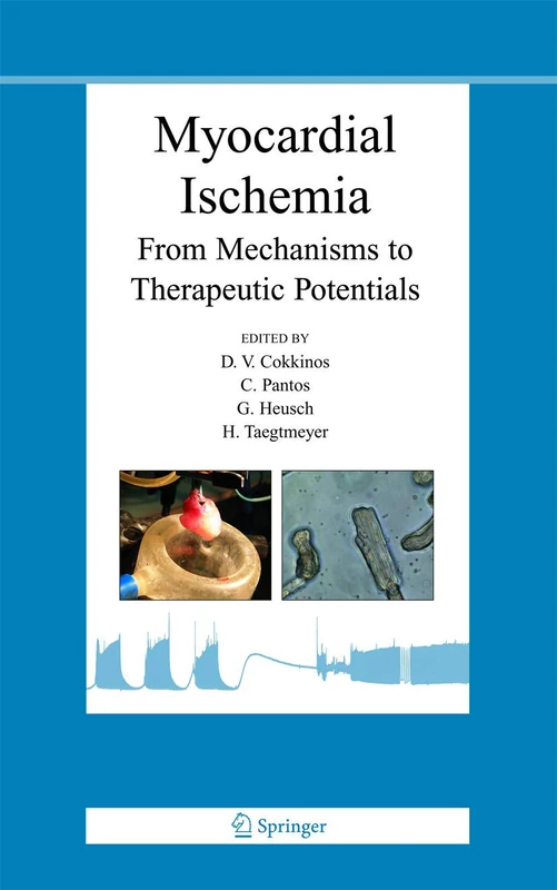 Myocardial Ischemia: From Mechanisms to Therapeutic Potentials: 21 (Basic Science for the Cardiologist, 21)