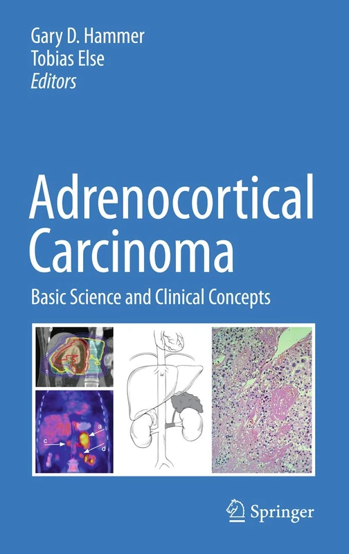 Adrenocortical Carcinoma: Basic Science and Clinical Concepts - Image 1