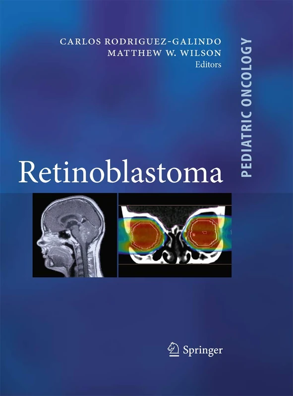 Retinoblastoma (Pediatric Oncology)