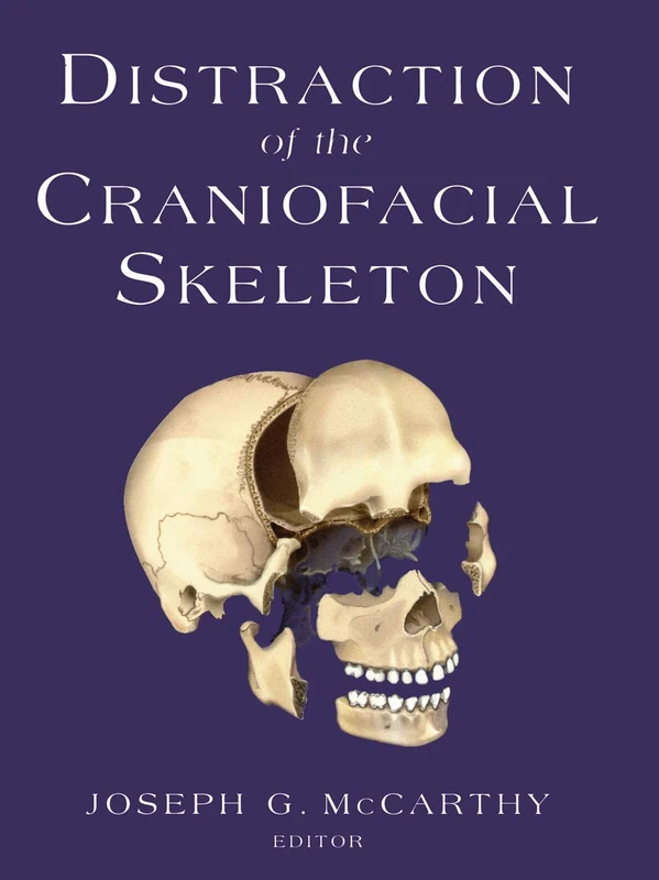Distraction of the Craniofacial Skeleton (M.D. Anderson Solid Tumor Oncology)