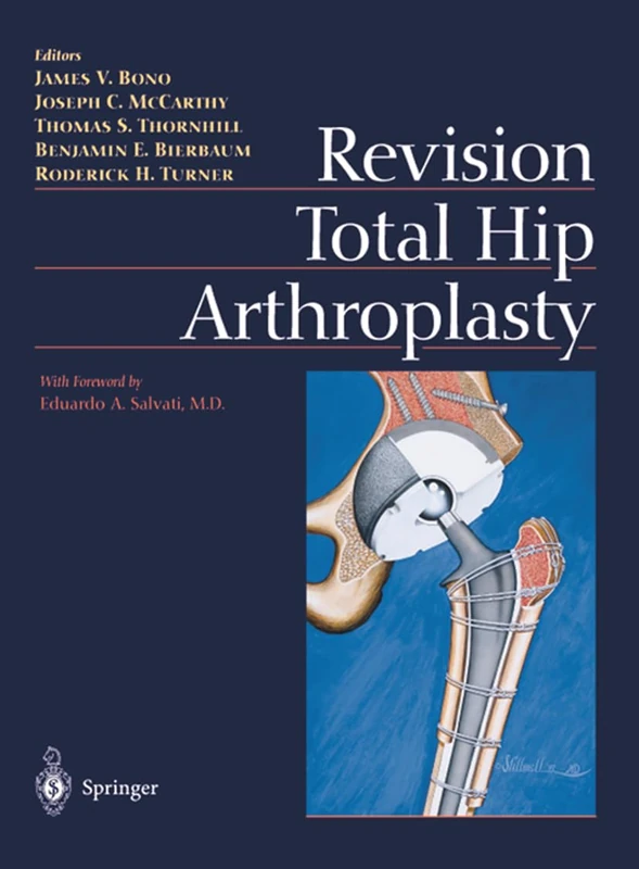 Revision Total Hip Arthroplasty