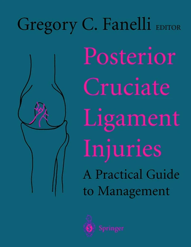 Posterior Cruciate Ligament Injuries: A Practical Guide to Management