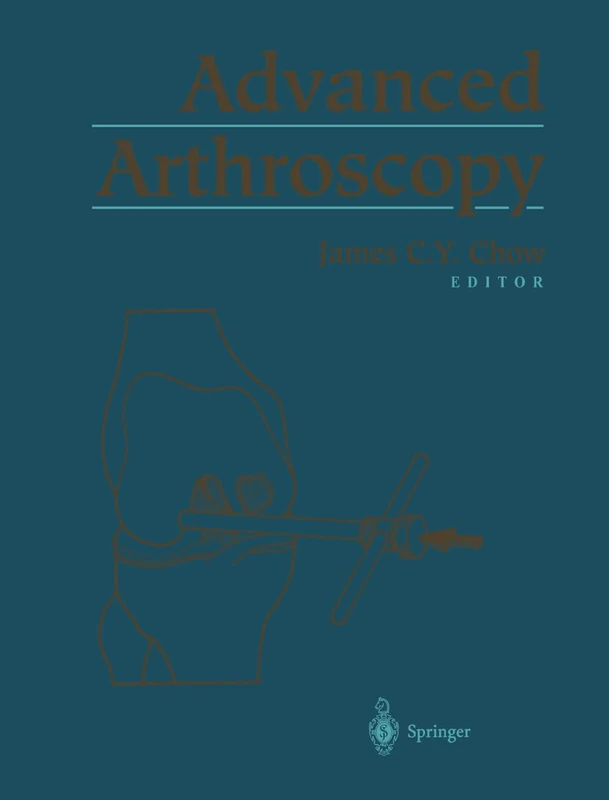 Advanced Arthroscopy