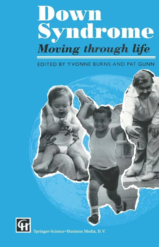 Down Syndrome: Moving through life