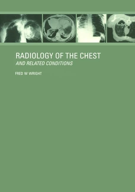 Radiology of the Chest and Related Conditions: Together with an extensive illustrative collection of radiographs, conventional and computed tomograms, ... for Mac and Windows version 3.1 or later)