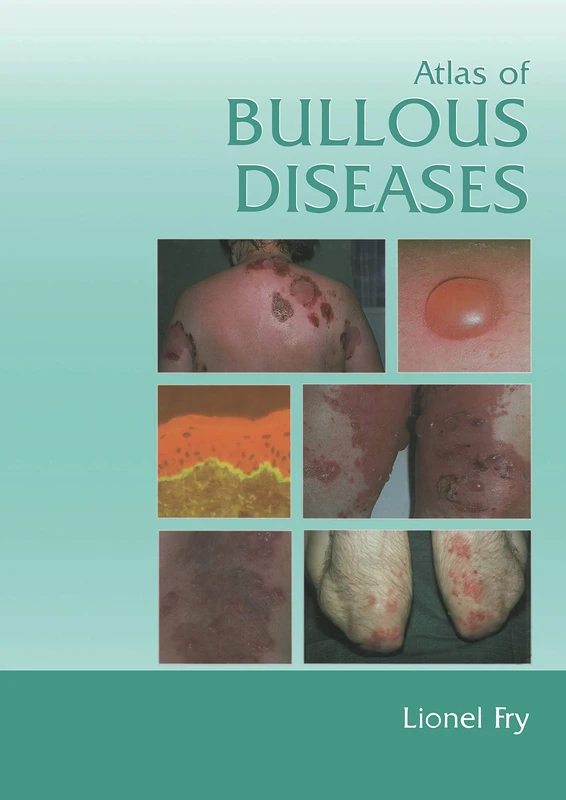 Atlas of Bullous Diseases - Image 1