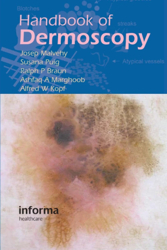 Handbook of Dermoscopy