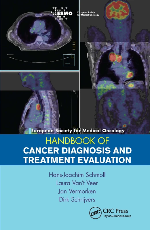 ESMO Handbook of Cancer Diagnosis and Treatment Evaluation (European Society for Medical Oncology Handbooks)