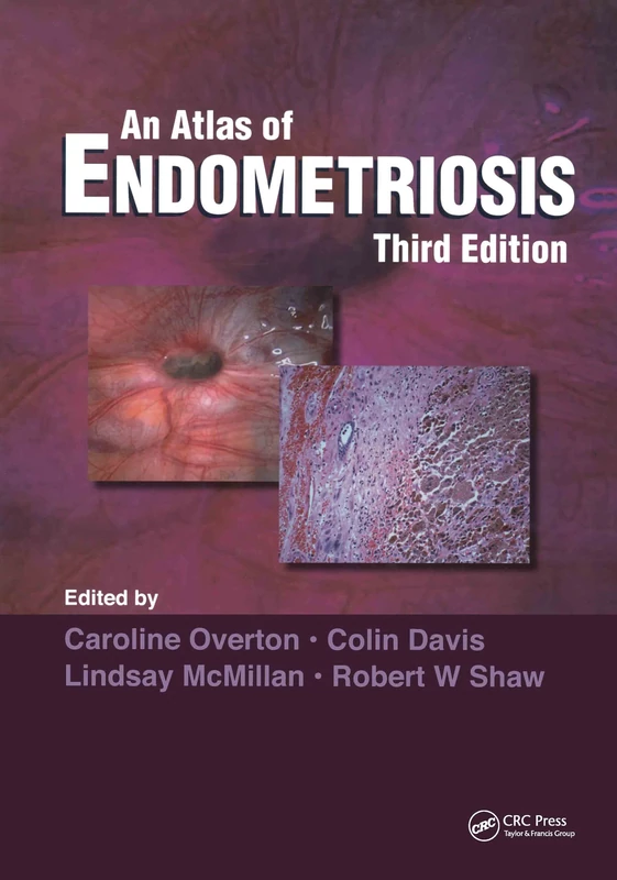 CRC Press An Atlas of Endometriosis - 3rd Edition Medical Book