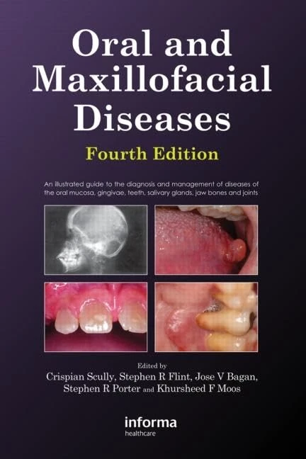 Oral and Maxillofacial Diseases, Fourth Edition: An Illustrated Guide to the Diagnosis and Management of Diseases of the Oral Mucosa, Gingivae, Teeth, Salivary Glands, Jaw Bones and Joints